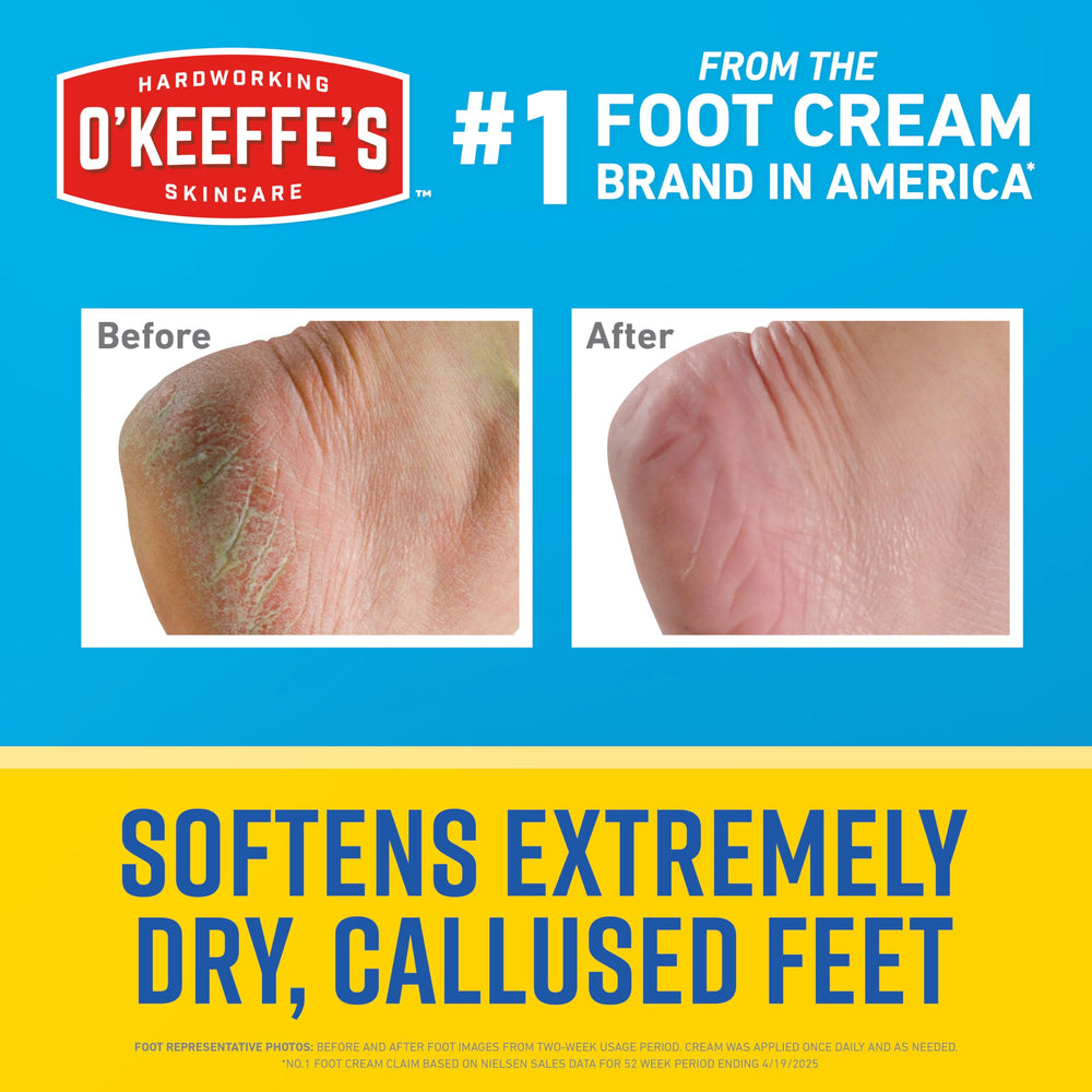 O'Keeffe's Healthy Feet feet close-up after use showing smoother skin