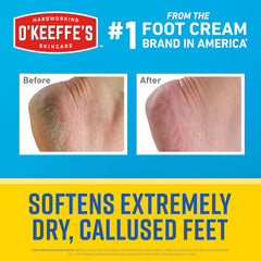O'Keeffe's Healthy Feet feet close-up after use showing smoother skin