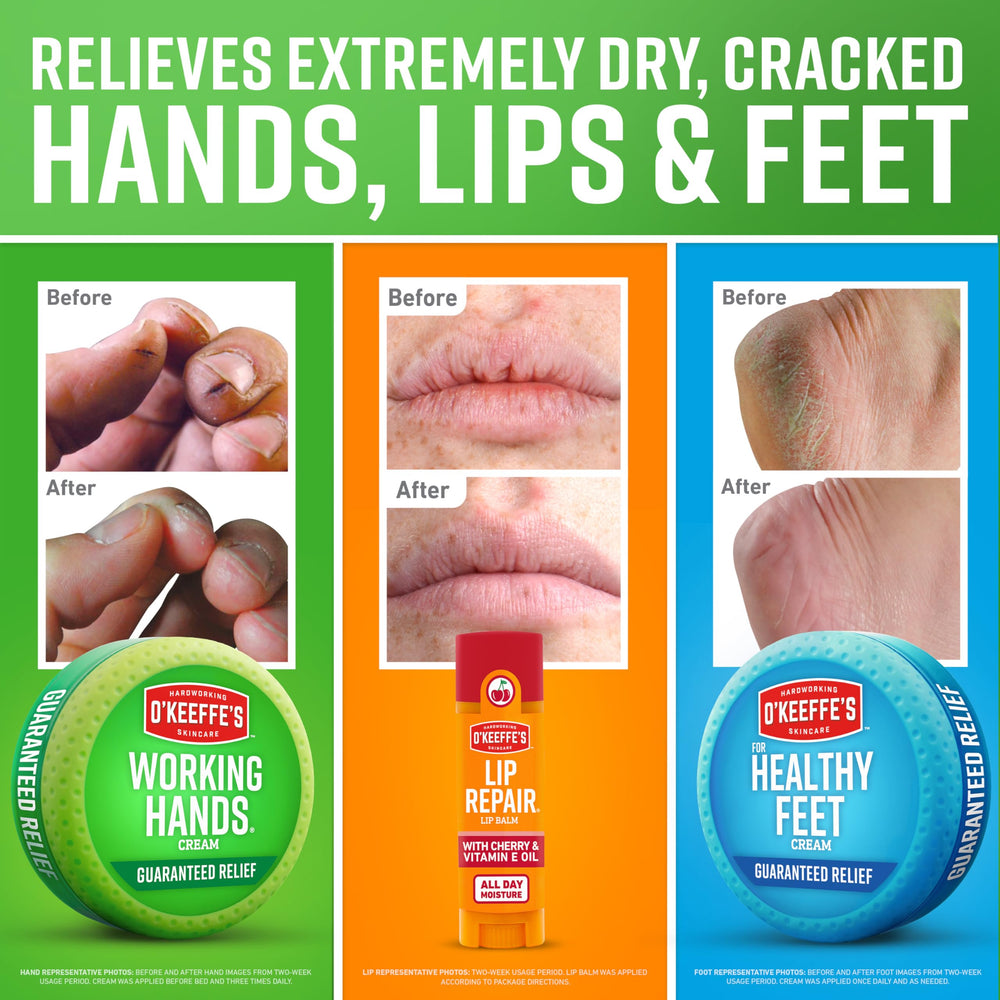 O'Keeffe's Working Hands jar hydrates and protects extremely dry hands.