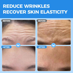 Okela forehead patches on forehead closeup demonstrate patch adhesion for overnight wear.