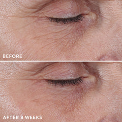 Olay Regenerist cream on hand being spread to show easy application benefit