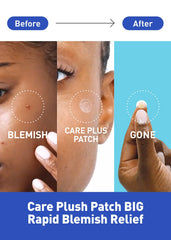 OLIVE YOUNG Care Plus Spot Patch adhesion detail highlights strong, skin-safe grip.
