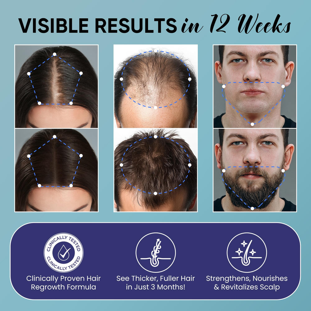 OLIVITA minoxidil fast-absorbing spray dries quickly for mess-free daily use.