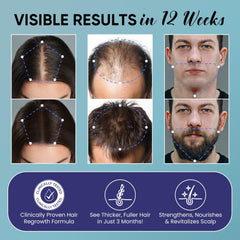 OLIVITA minoxidil fast-absorbing spray dries quickly for mess-free daily use.