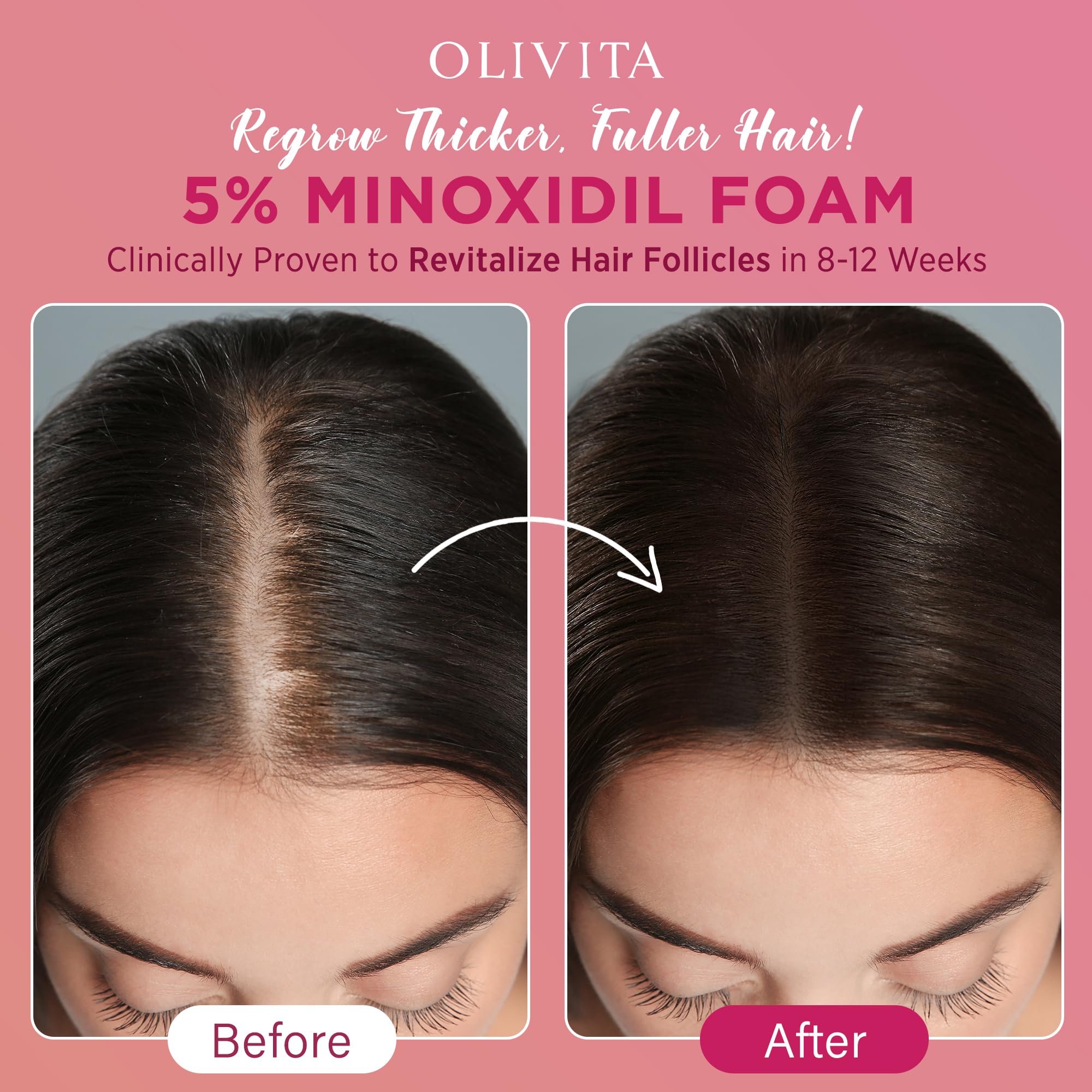 OLIVITA Minoxidil Foam quick-dry texture highlighting non-greasy finish