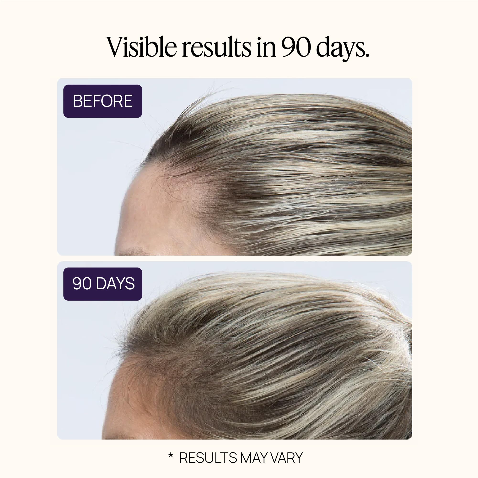 OMI WellBeauty before/after concept visual hints at fuller-looking hair.
