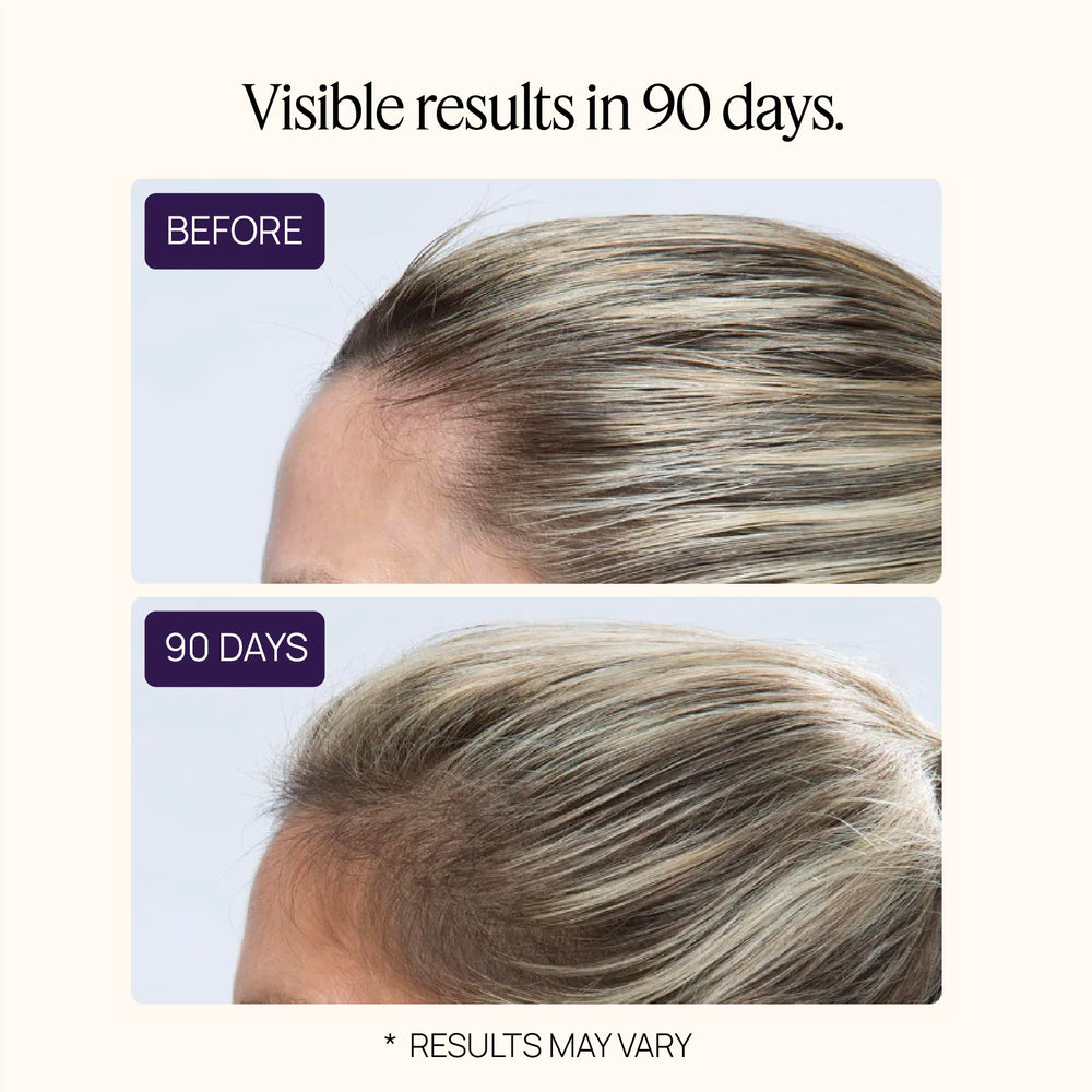 OMI WellBeauty before/after concept visual hints at fuller-looking hair.