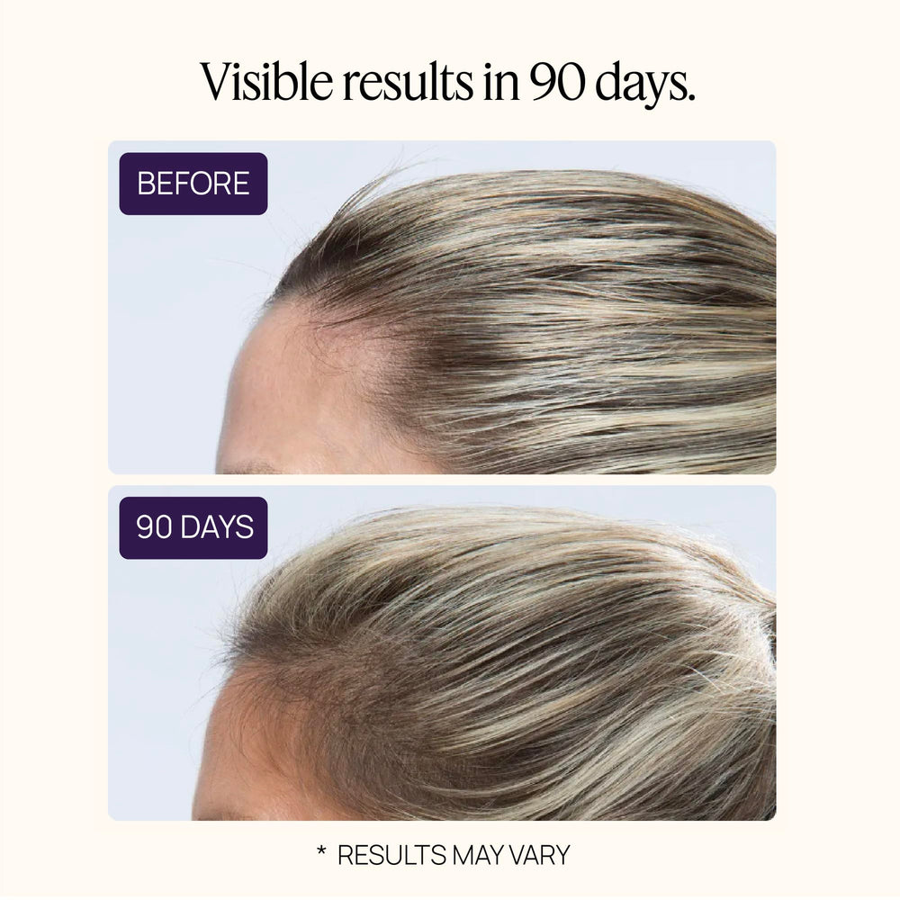 OMI WELLBEAUTY Follicle Fortifying Biotechnology illustration explains the science concept.