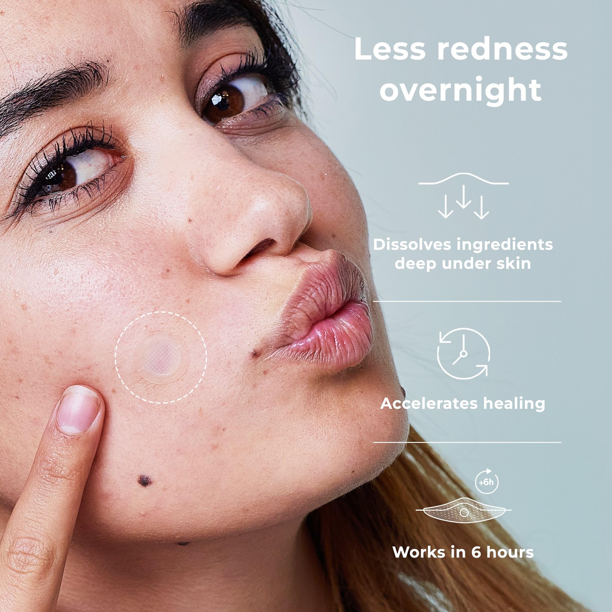 OMMA Korean acne patch on zit face demonstrates overnight treatment potential.
