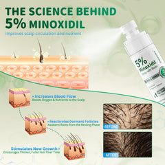 ONIADBA minoxidil formula with biotin and castor oil nourishes scalp.
