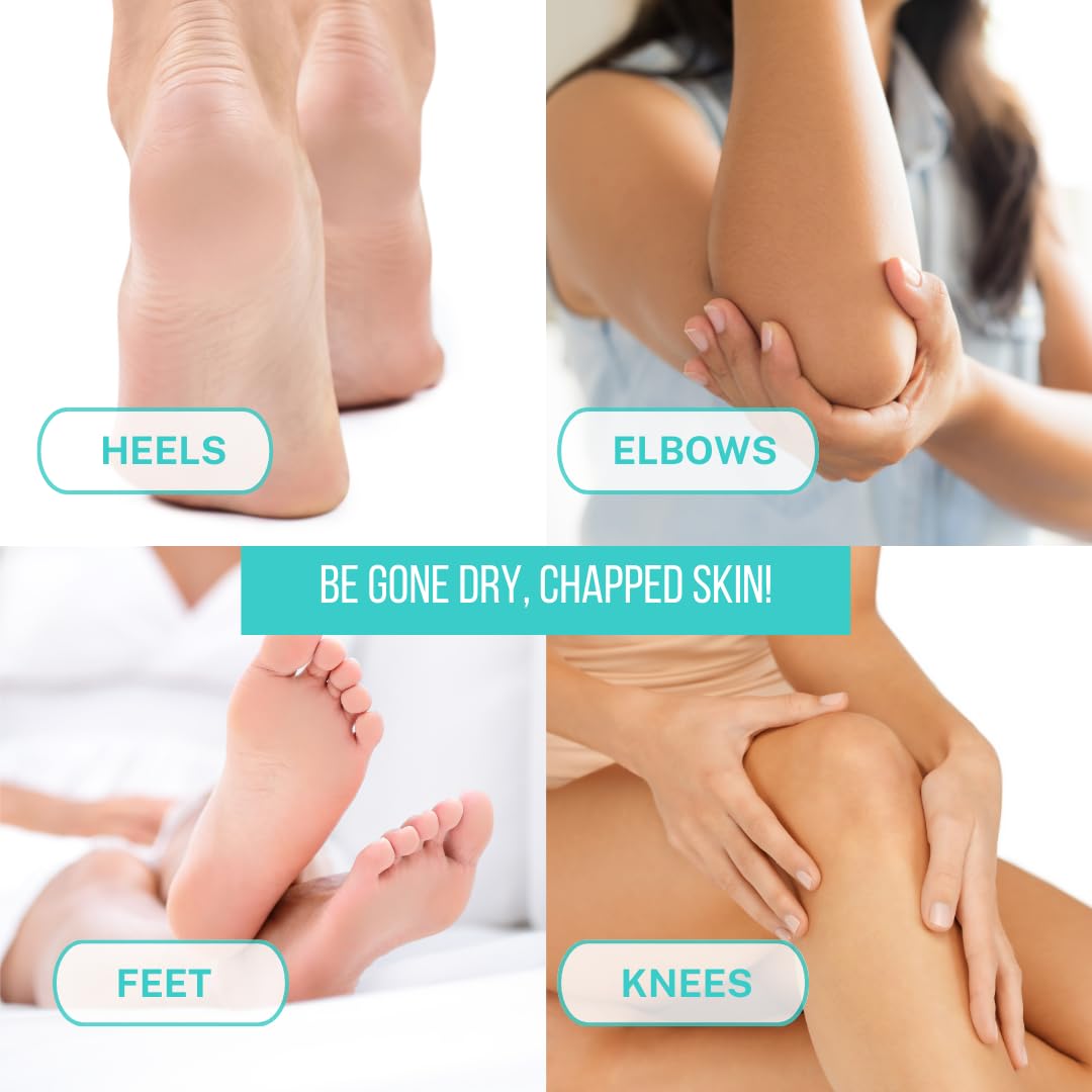 Onyx Professional dry feet care balm applying to rough skin