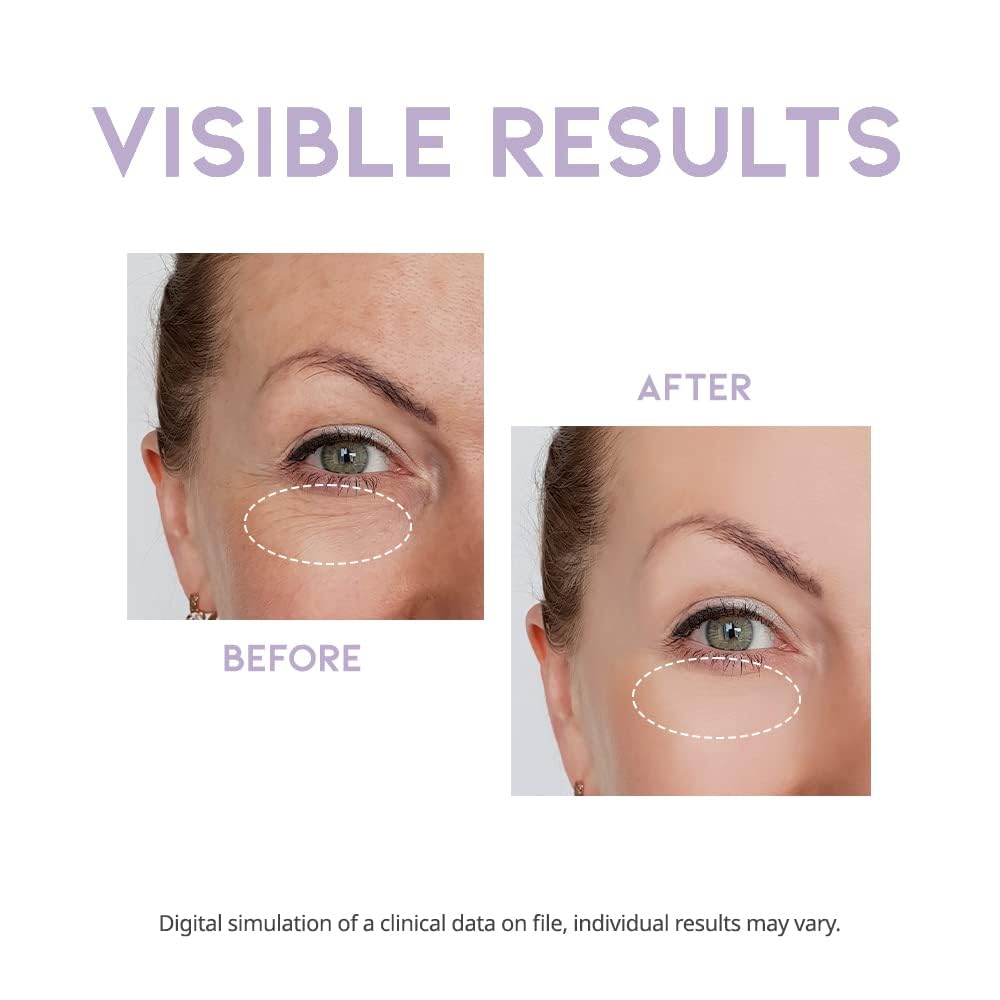 OOTD eye cream with vitamin C protects skin from free radicals and brightens