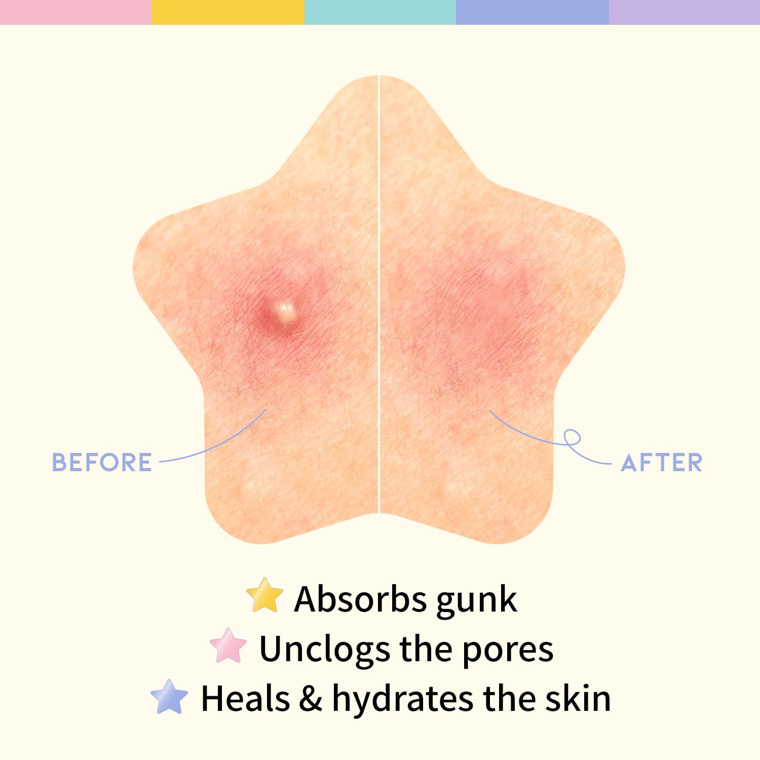 ootd star-pimple-patches night-use applied before sleep for blemish protection