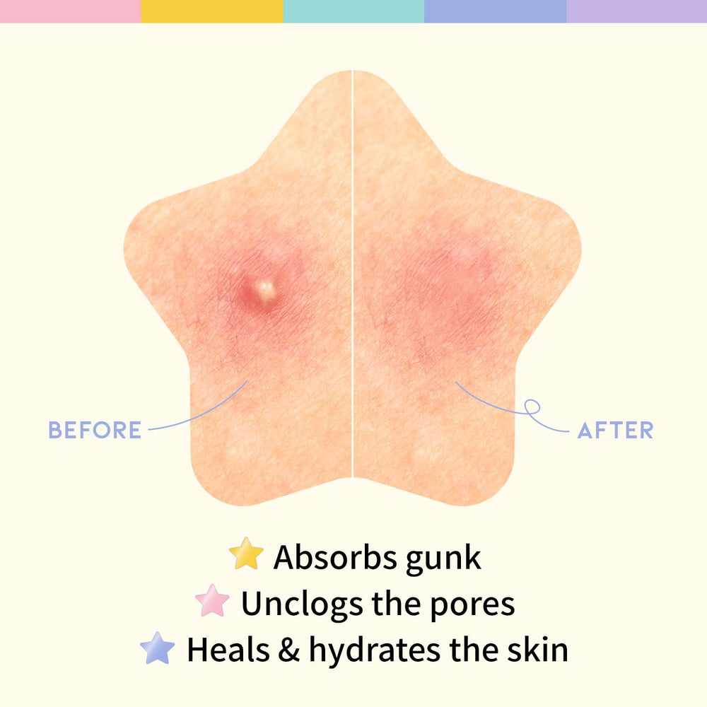 ootd star-pimple-patches night-use applied before sleep for blemish protection