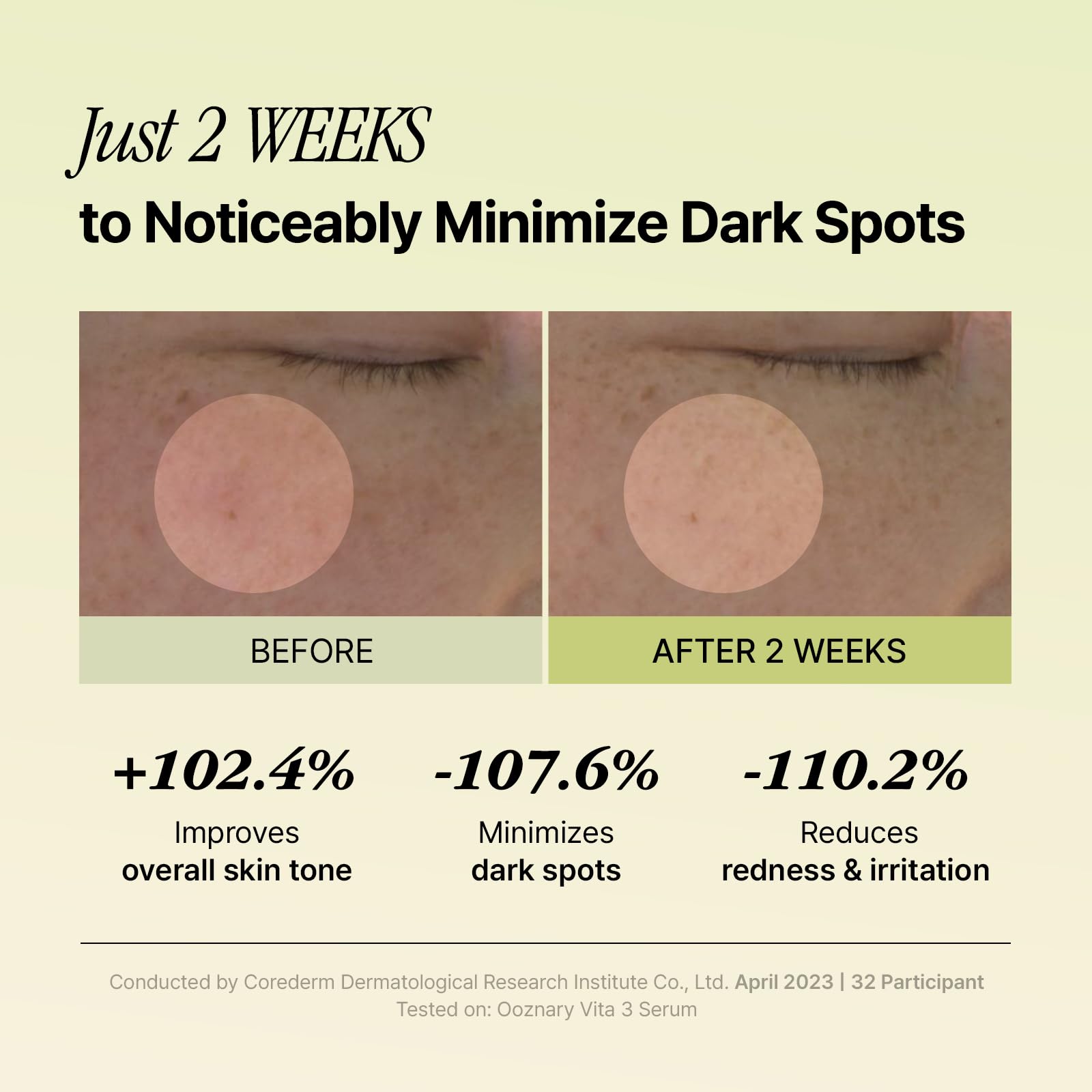 OOZNARY Vita 3 serum Vitamin C derivatives support gentle brightening.