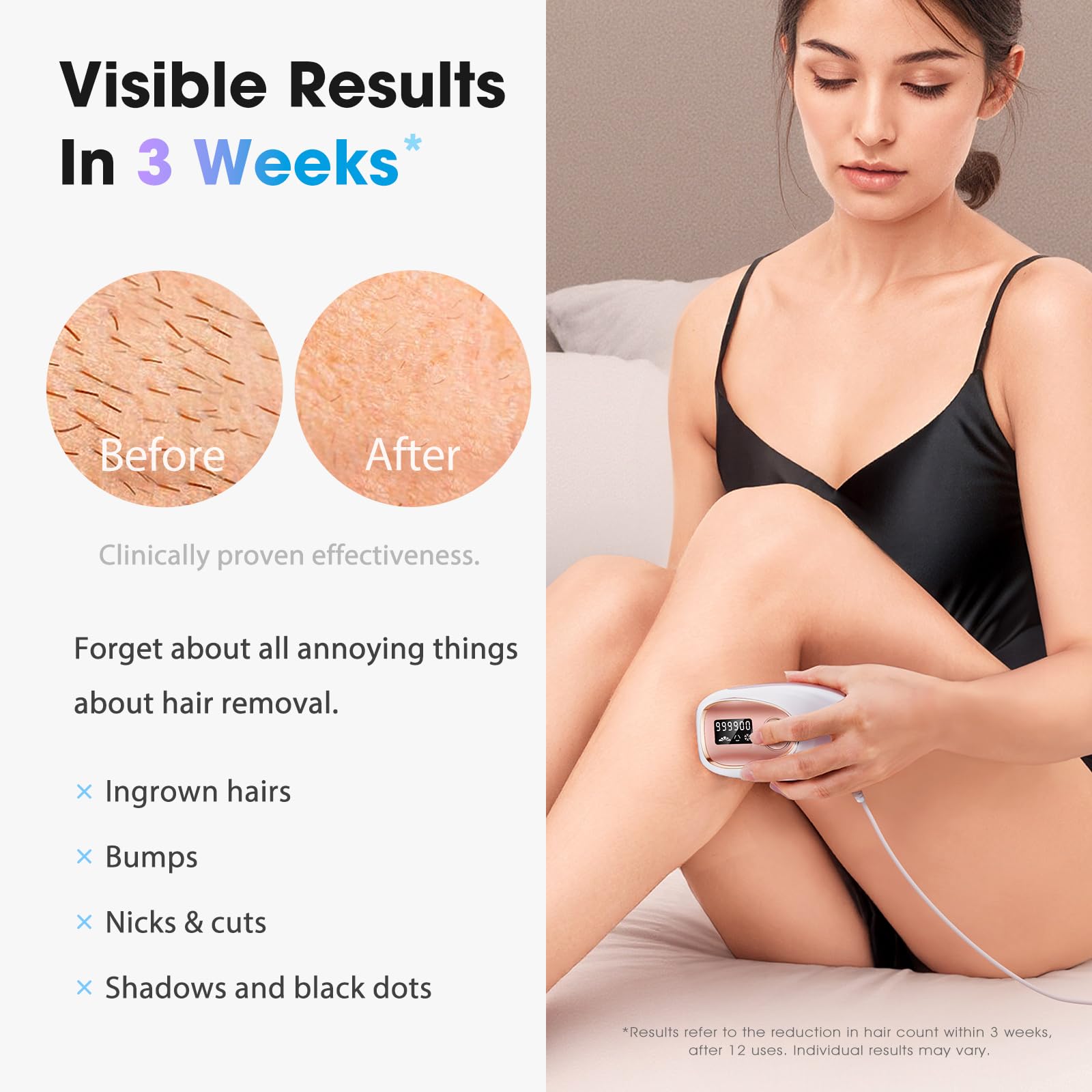 Oreeth IPL laser device rose gold side view showing compact handheld design