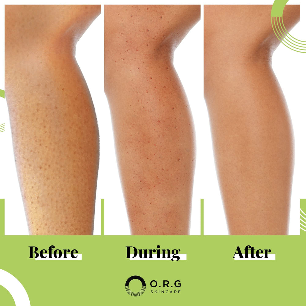 ORG Skincare product shot demonstrates non-alcohol, paraben-free promise for sensitive skin.