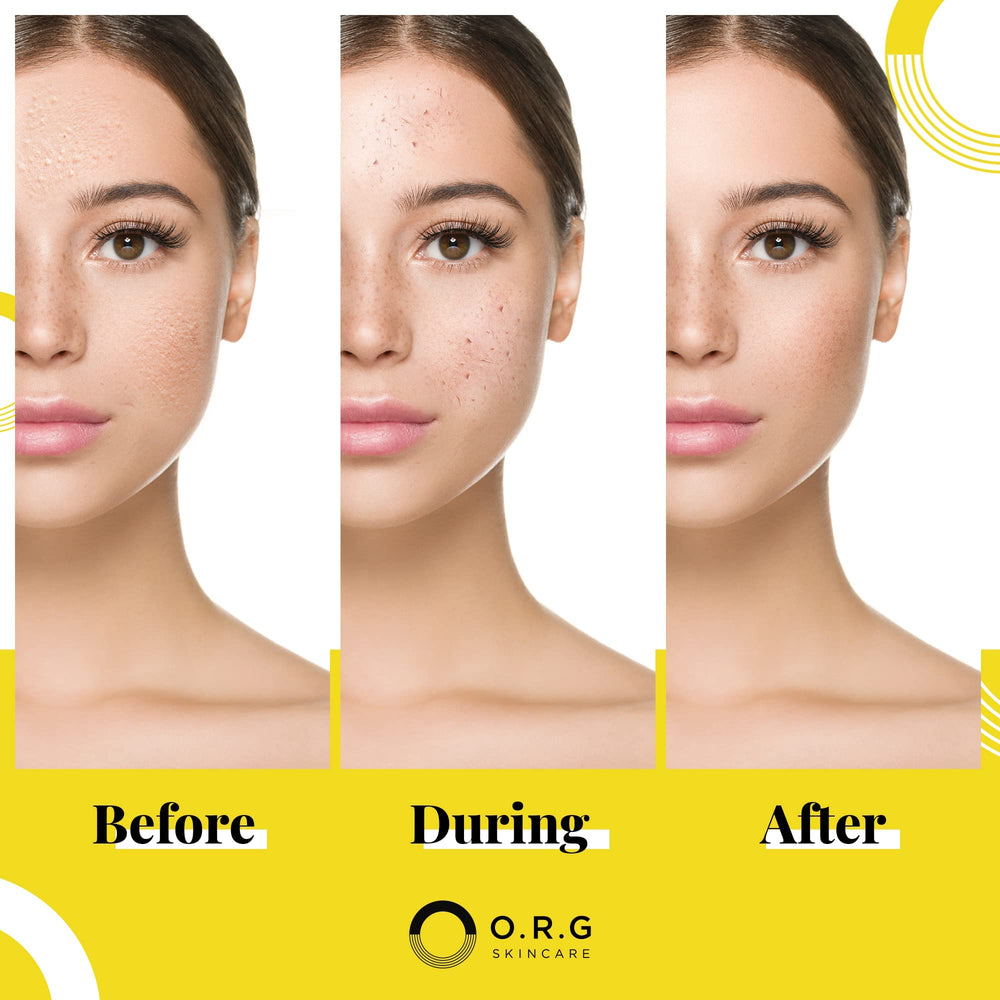 ORG Skincare USA-made packaging emphasizes natural formula and quality