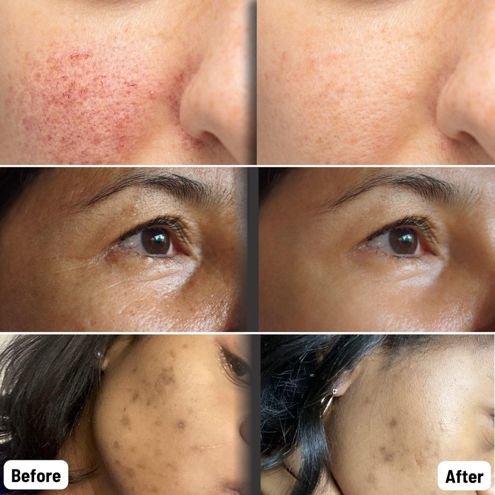 ORGAID Organic Sheet Mask close-up on smooth, hydrated skin after use.