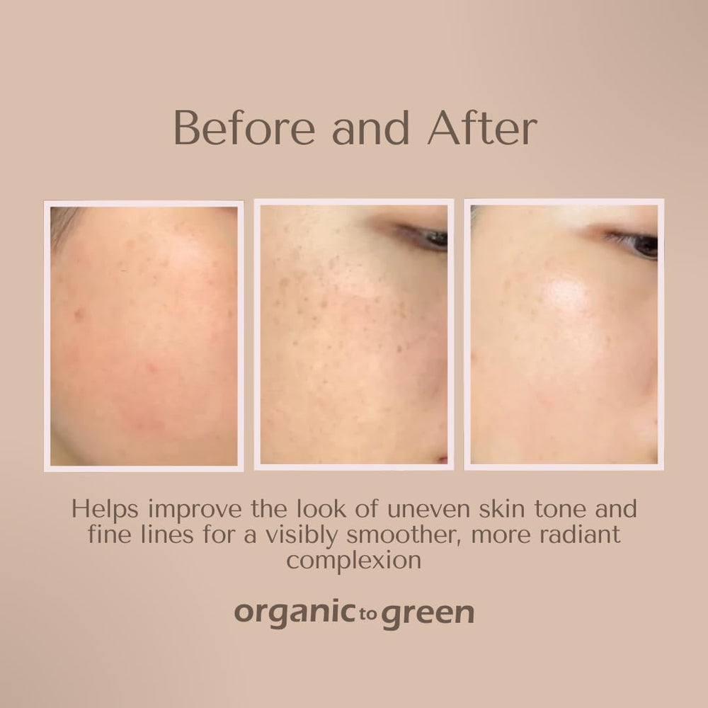 Organic To Green Kojic Turmeric Soap lavender pack shot evokes calm spa like moment in shower rituals.