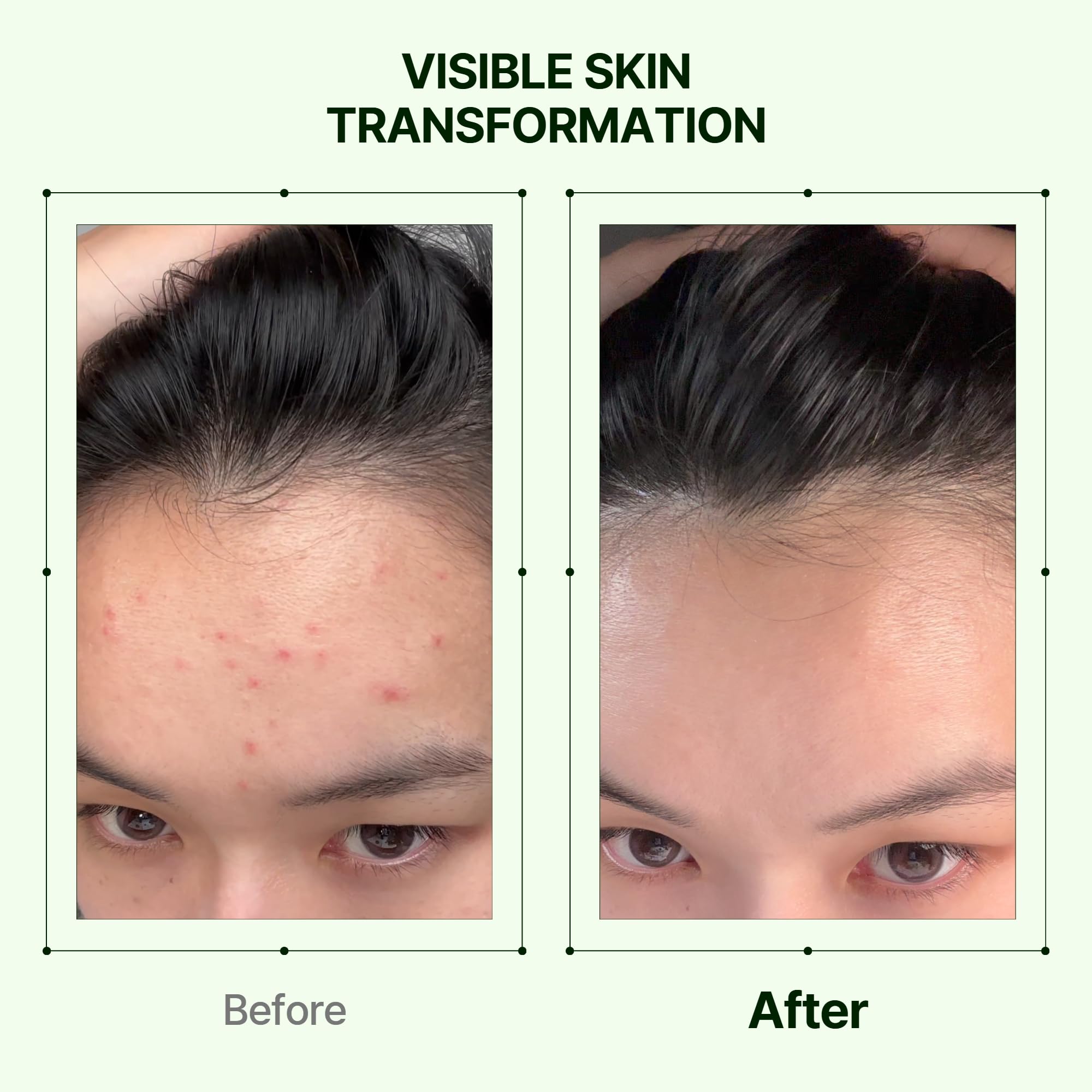 Orien Mugwort Soothe Toner applied to cotton pad for refreshing cleansing