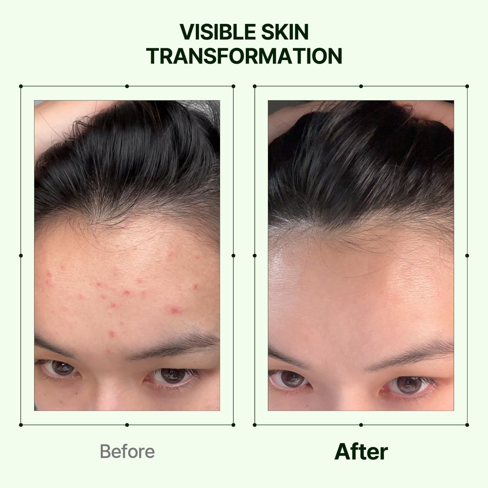 Orien Mugwort Soothe Toner applied to cotton pad for refreshing cleansing