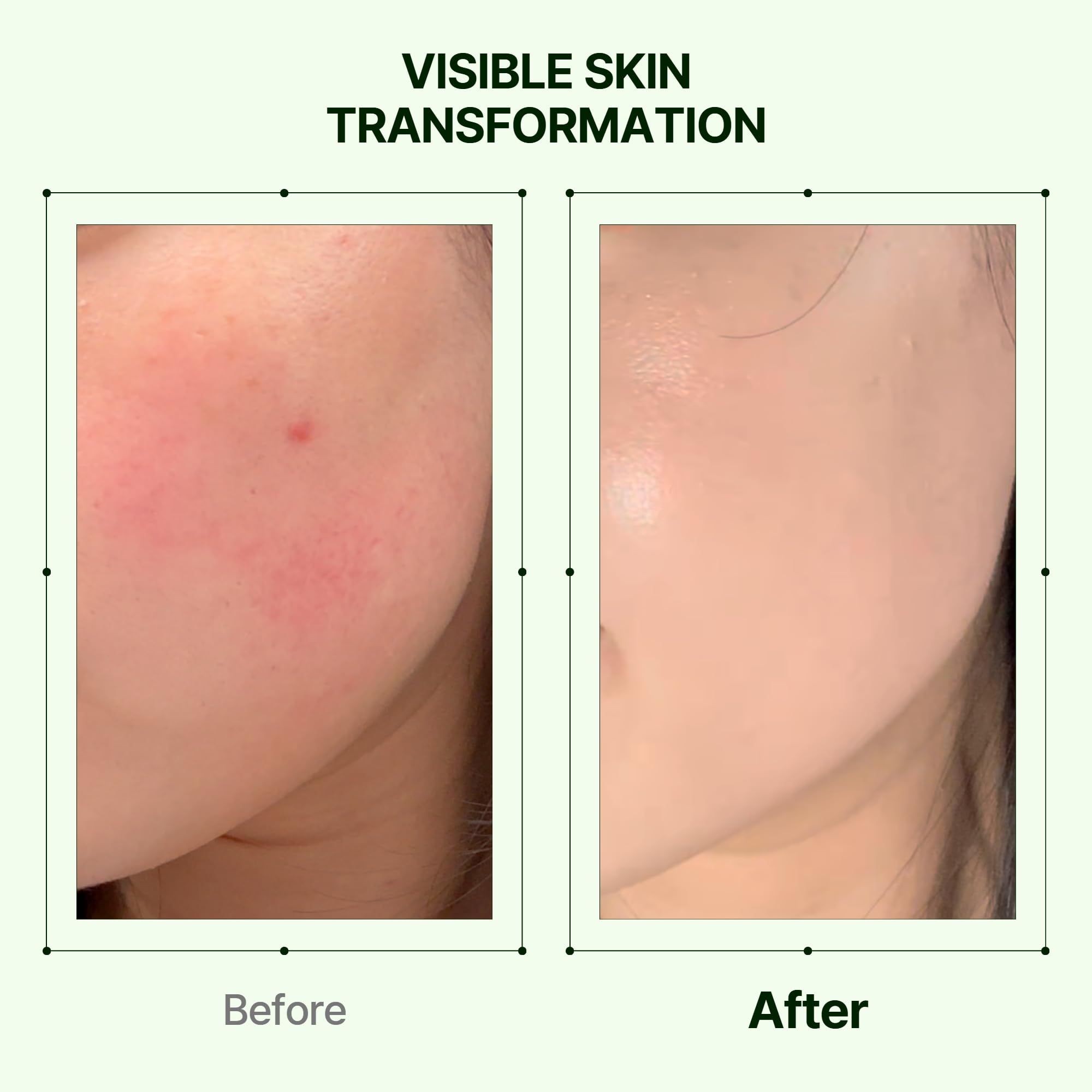 Orien Mugwort Zero Film Moisturizer texture close-up suggests soothing finish.