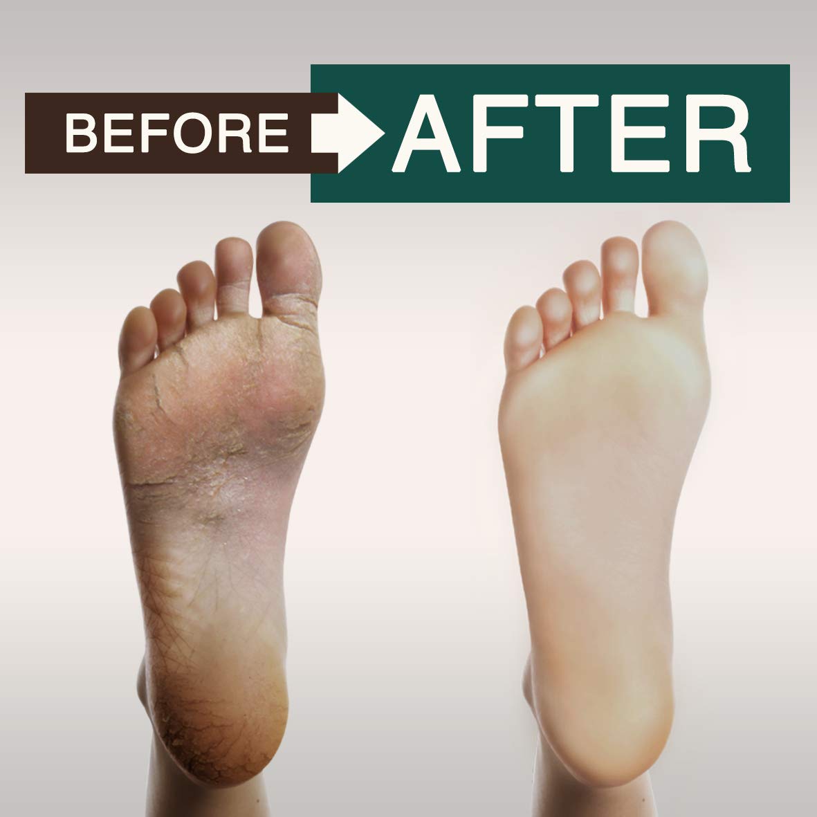 ORISO Tea Tree Oil Body Wash promotes moisturized skin after cleansing