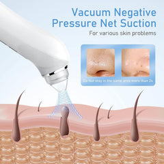Ottleba Blackhead Remover Vacuum includes interchangeable suction heads for versatile cleansing.