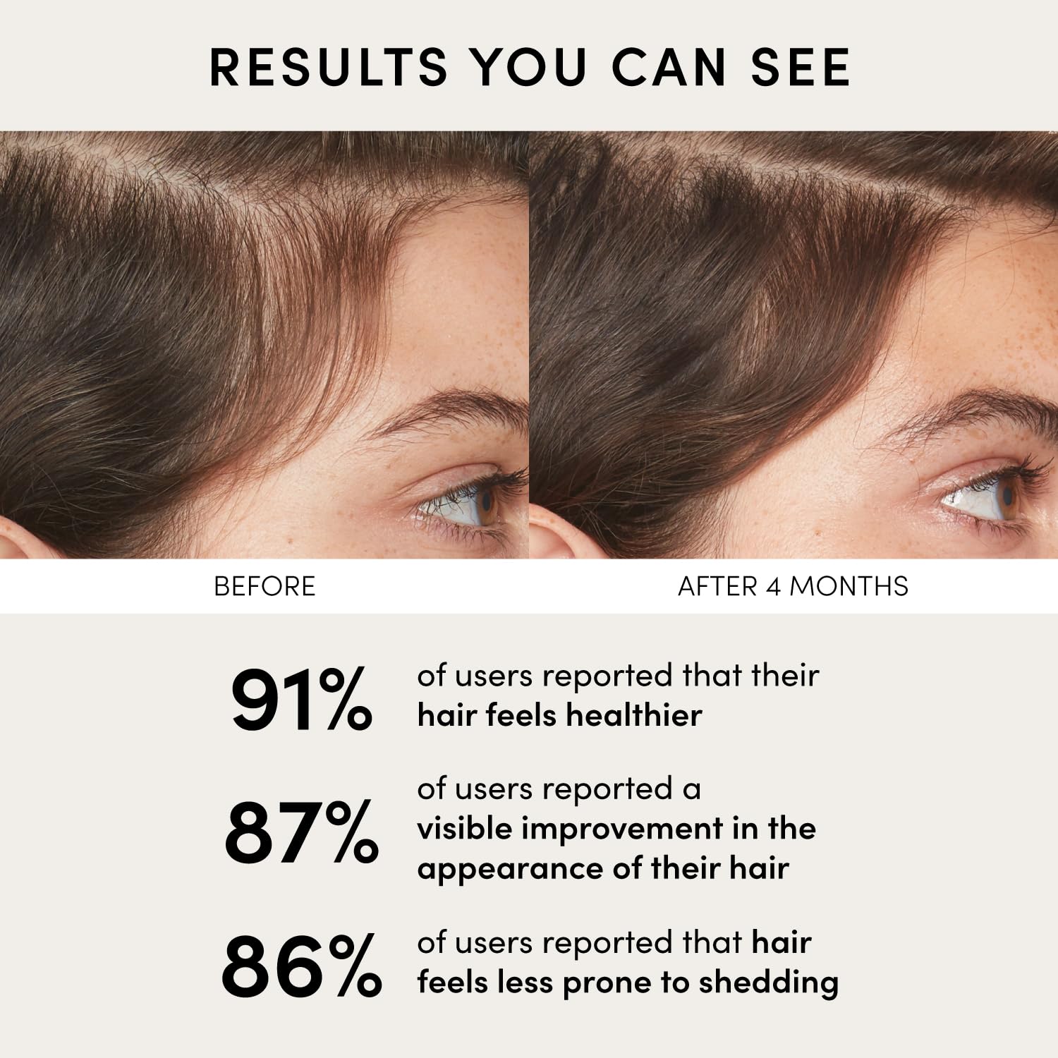 OUAI Scalp Serum adaptogens art reveals Arctic Root and Siberian Ginseng benefits