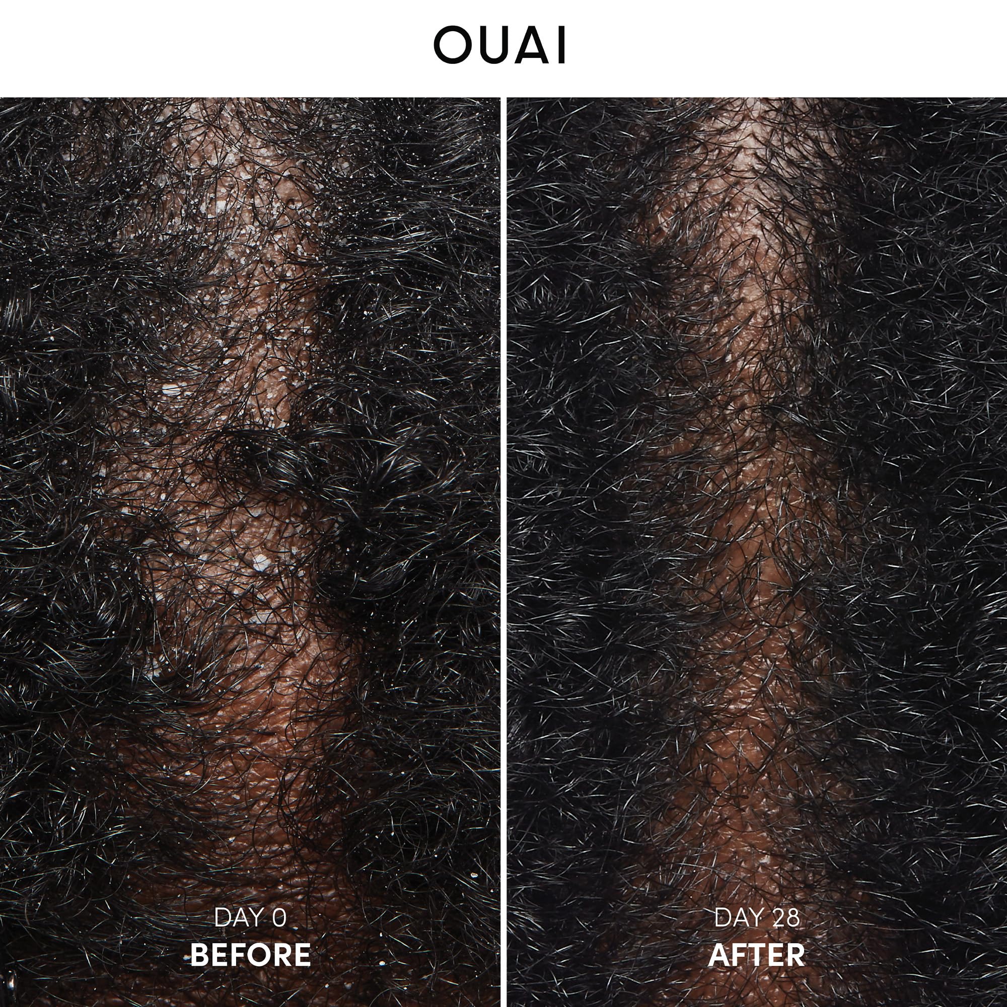 Ouai shampoo lather forming during application for flakes control