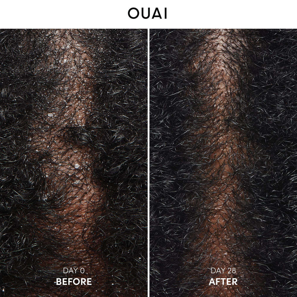 Ouai shampoo lather forming during application for flakes control