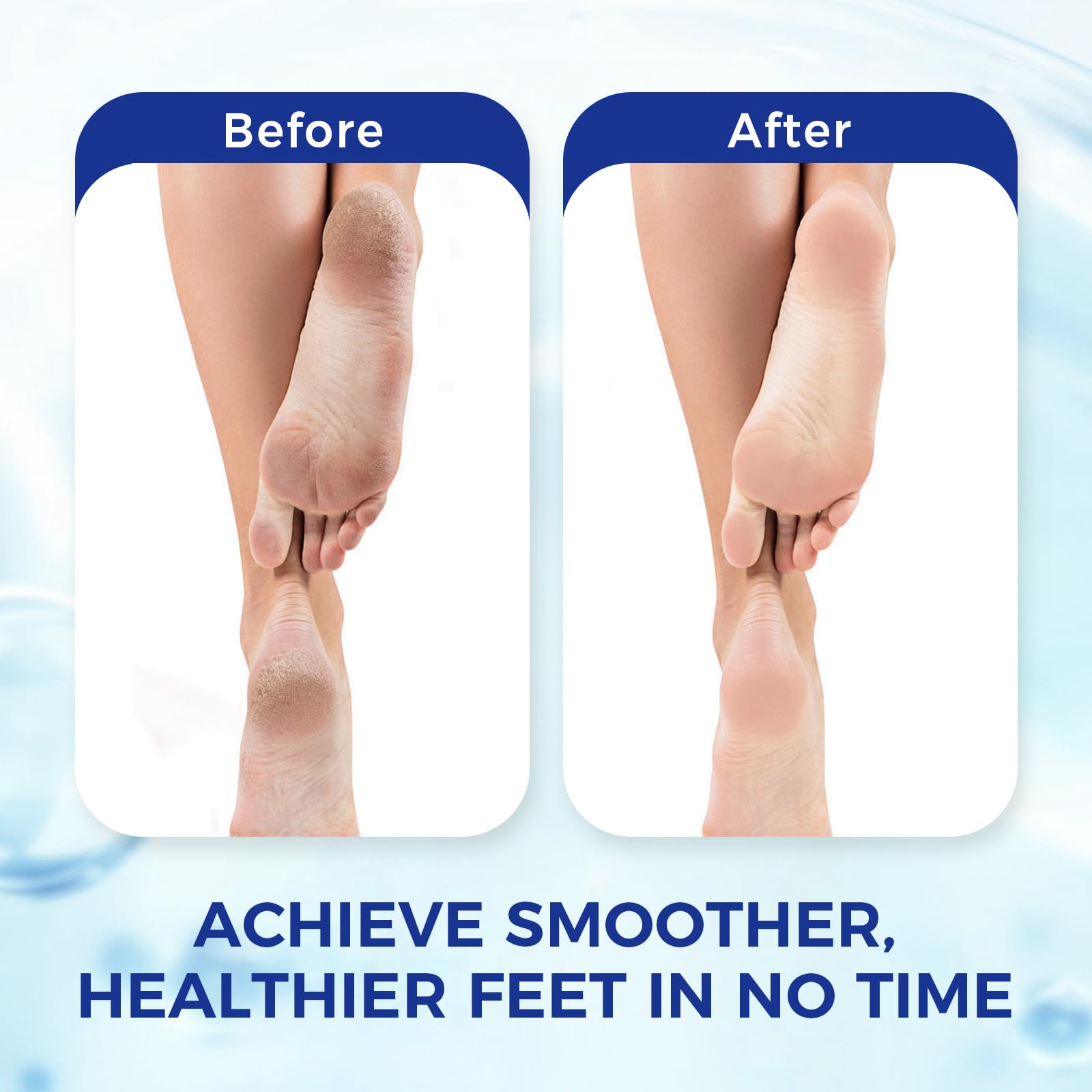 OUKEYA before and after feet comparison showing smoother skin benefit