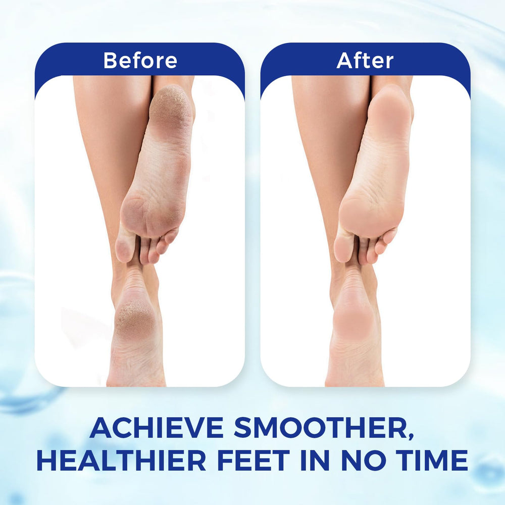 OUKEYA before and after feet comparison showing smoother skin benefit