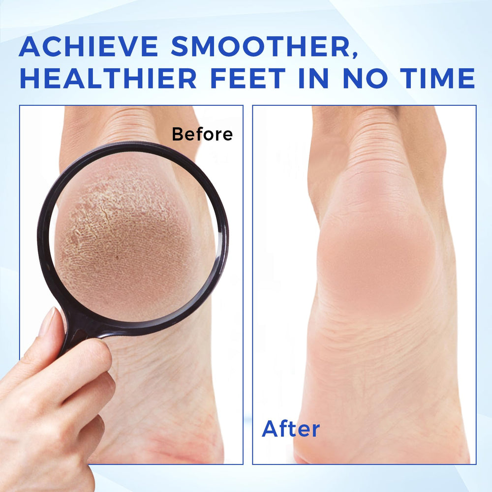 OUKEYA foot care lifestyle image showing confidence and comfort benefit