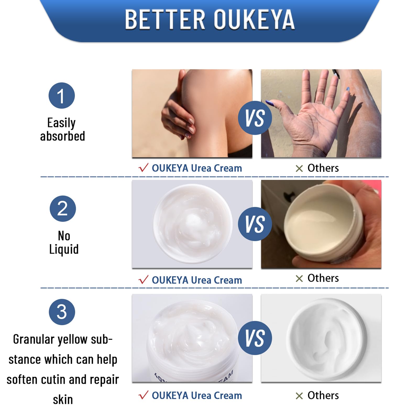 OUKEYA Urea Cream 40% non-greasy absorption supports quick daily use.