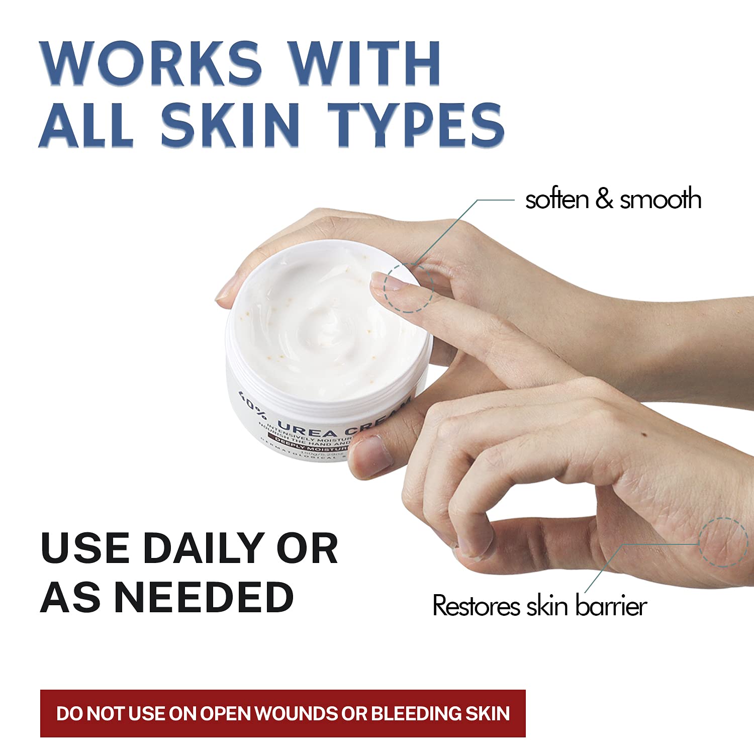 OUKEYA Urea Cream 40% suitable for daily skin care routines.