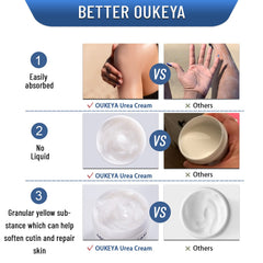 OUKEYA Urea Cream 40% applied to dry elbows for softer skin.