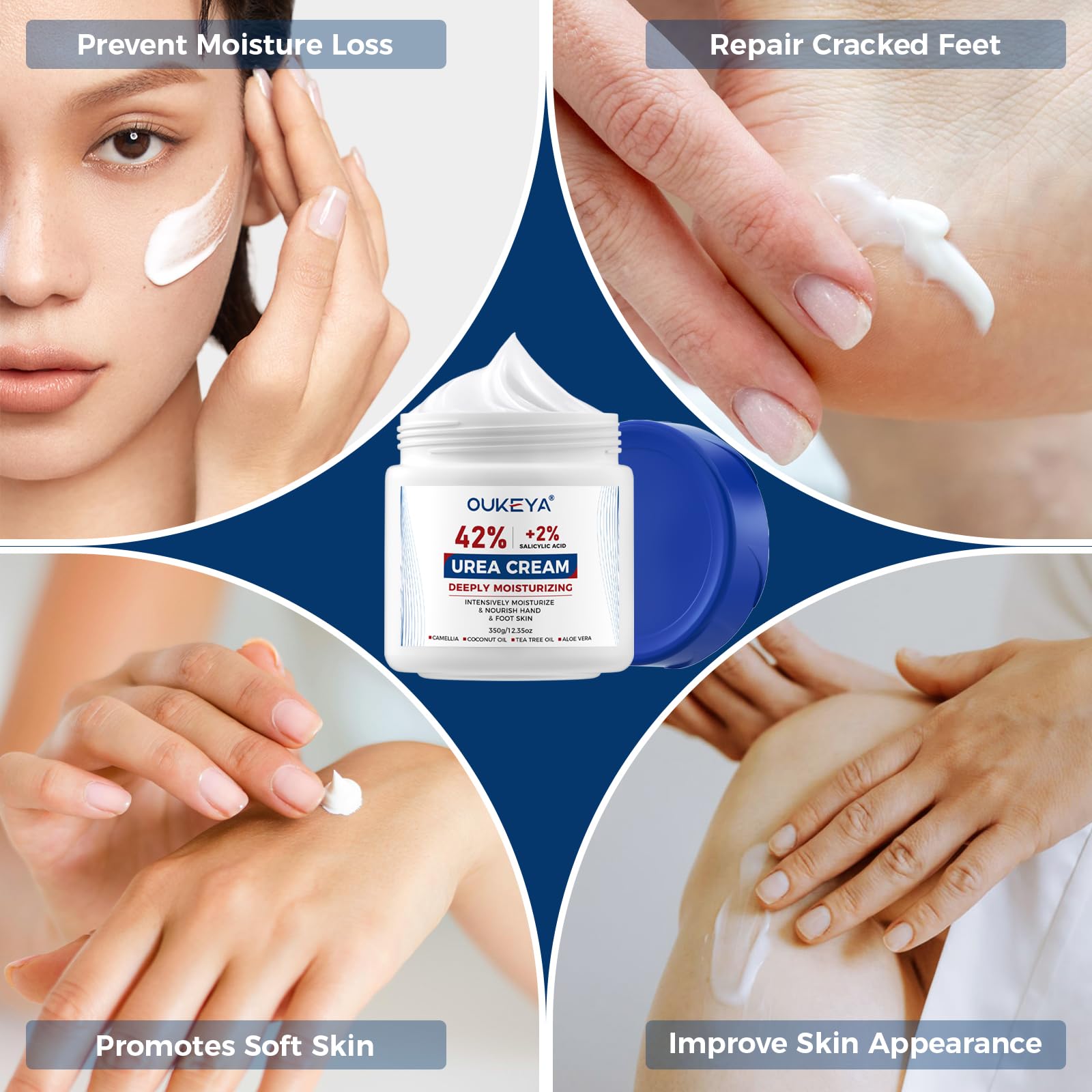 OUKEYA Urea Cream used on feet and hands for ongoing care.