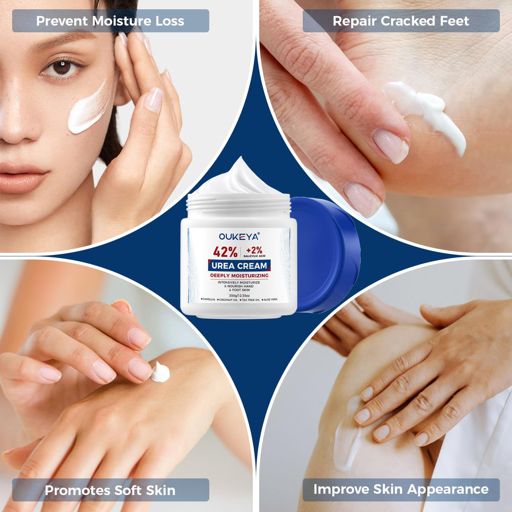 OUKEYA Urea Cream used on feet and hands for ongoing care.