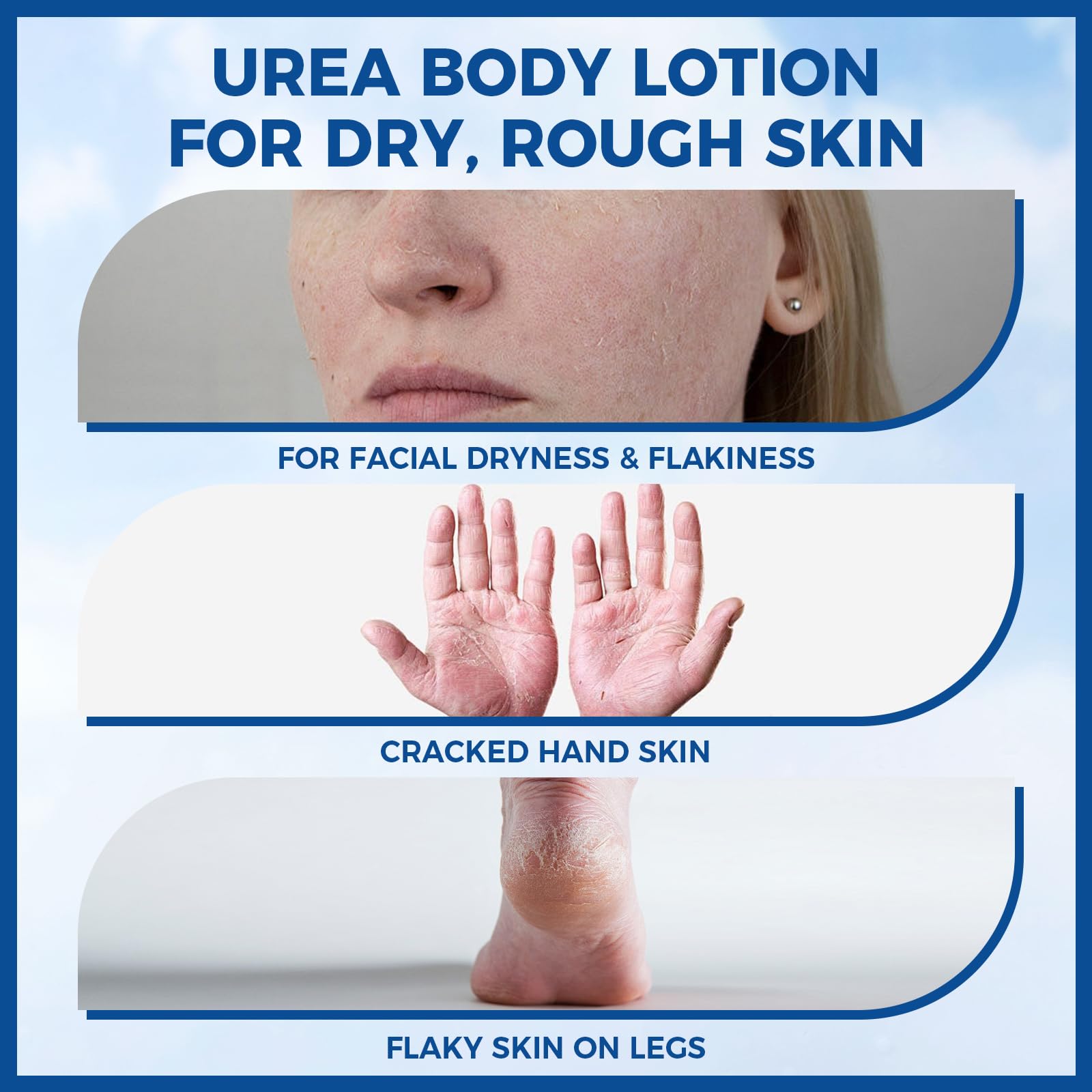 OUKEYA Urea Cream jar close-up showing creamy texture and fast absorption.
