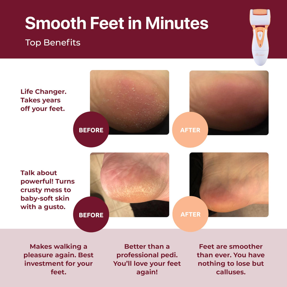 Own Harmony Rechargeable Callus Remover shows three roller heads for versatile care.