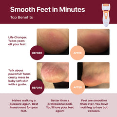 Own Harmony Rechargeable Callus Remover shows three roller heads for versatile care.