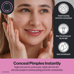 Oxy patches applied on cheek illustrating discreet coverage and confidence