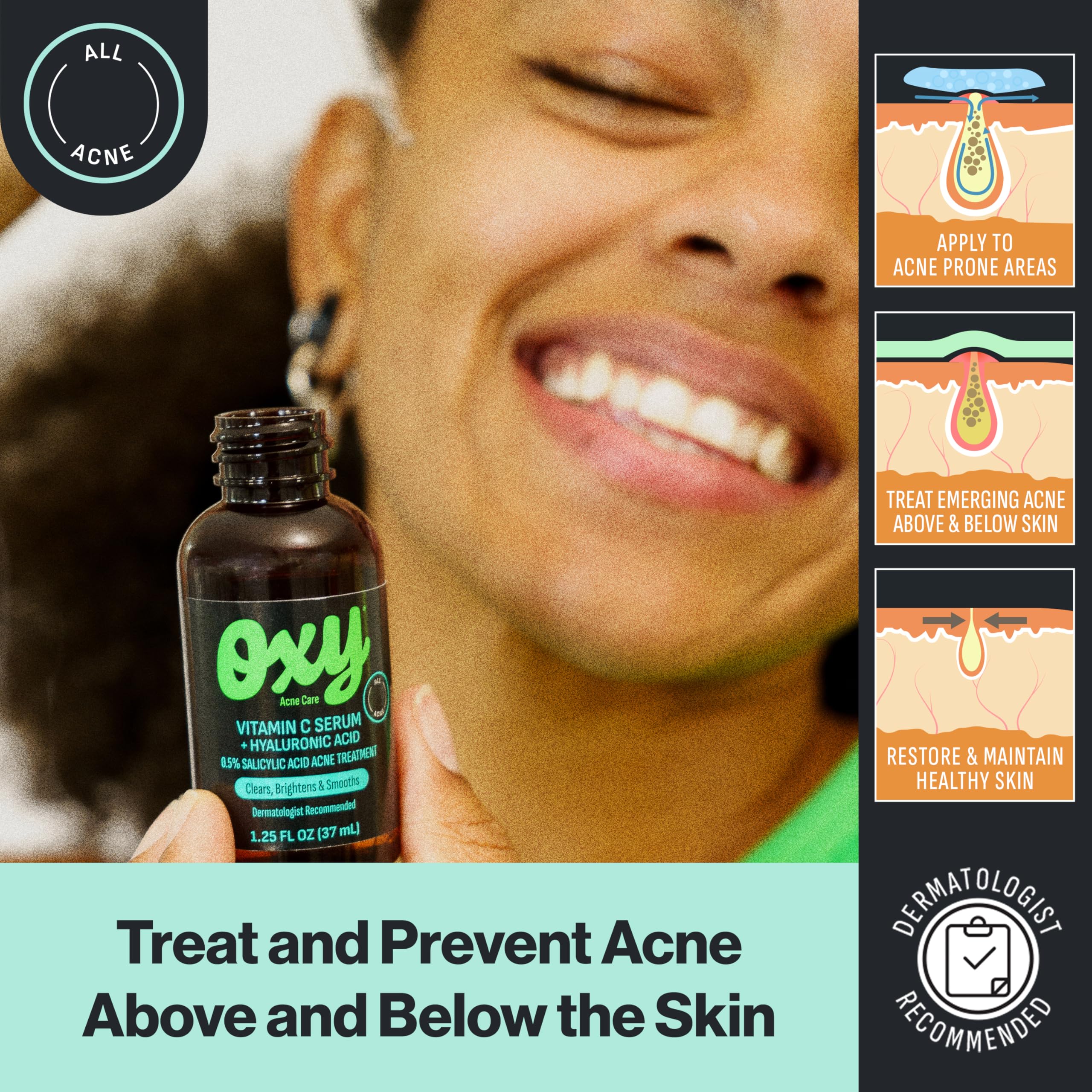Oxy Salicylic Acid penetrates pores for acne-prone skin care.