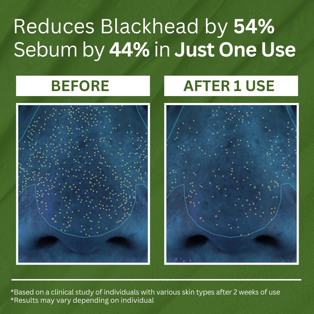 P.CALM PHA exfoliant detail indicates gentle skin refinement and oil control.
