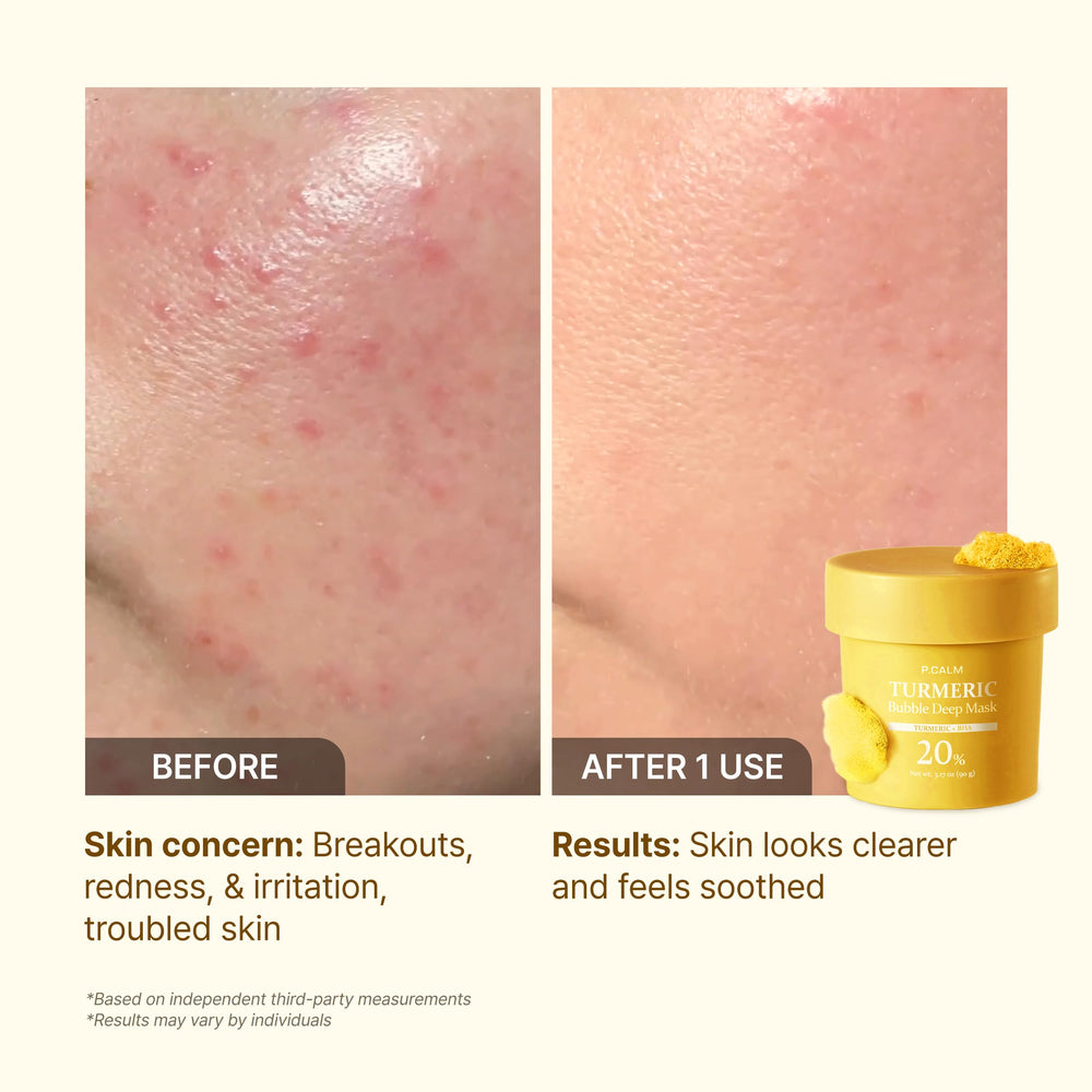 P.CALM Turmeric Bubble Deep Mask carbonated-water action shot emphasizes refreshing cleanse.