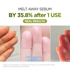 P.CALM Underpore oil texture on hand highlights gentle, non-greasy feel