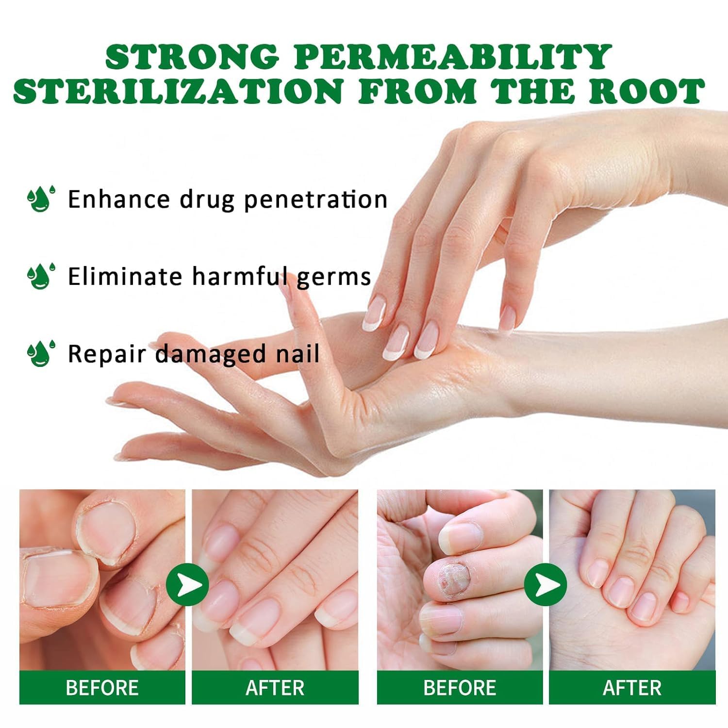 PARWENE nourishing formula bottle showcases nail hydration and conditioning.