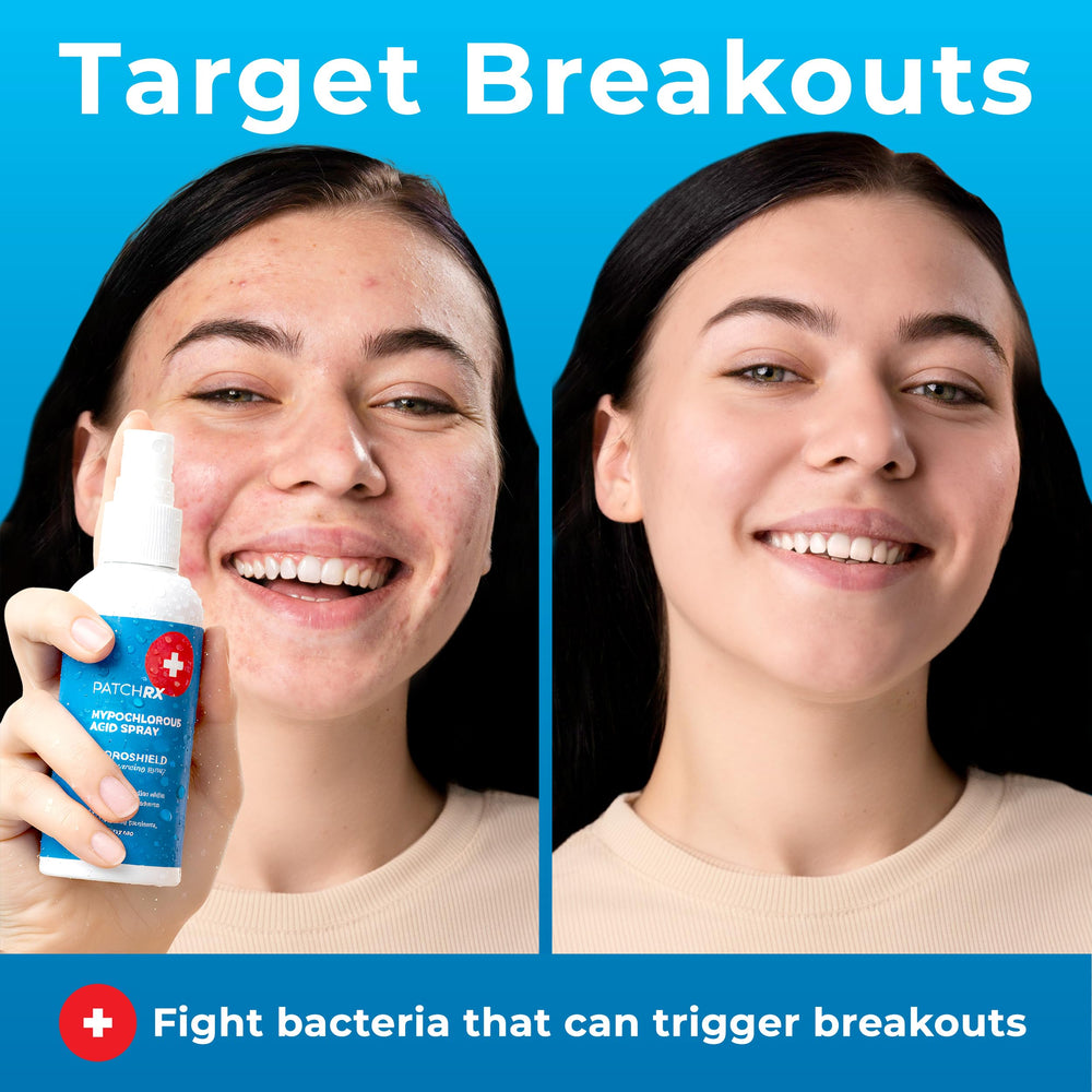 PatchRx HOCL spray 8oz two-pack bottle close-up in bathroom routine.